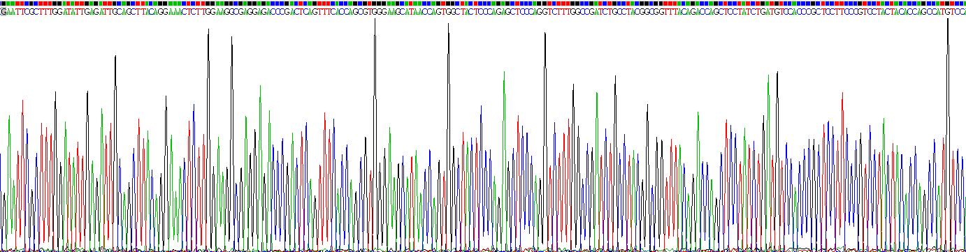 Recombinant Neurofilament, Light Polypeptide (NEFL)