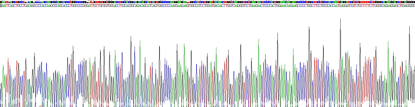 Recombinant Sodium Iodide Symporter (NIS)