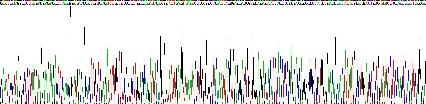 Recombinant Carnitine Palmitoyltransferase 1A, Liver (CPT1A)