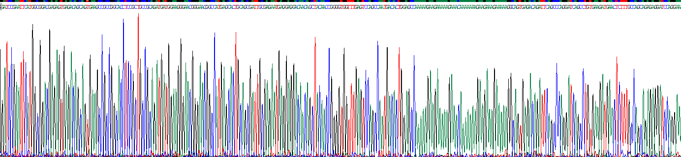 Recombinant N-Myristoyltransferase 1 (NMT1)