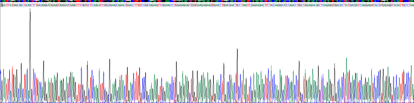 Recombinant DEAD Box Polypeptide 5 (DDX5)