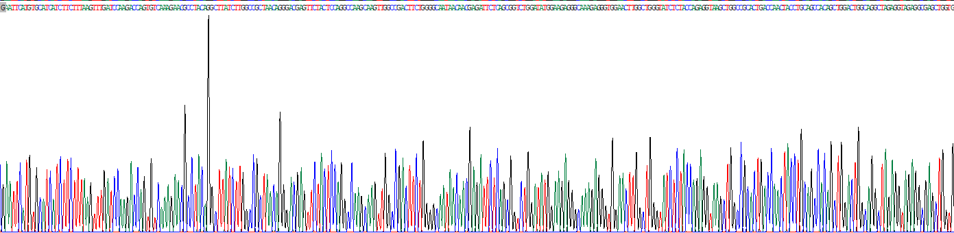 Recombinant Transport And Golgi Organization Protein 2 Homolog (TANGO2)