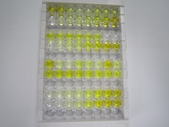 ELISA Kit for Matrix Metalloproteinase 1 (MMP1)