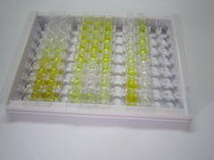 ELISA Kit for Retinol Binding Protein 4 (RBP4)