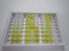 ELISA Kit for Retinol Binding Protein 4 (RBP4)