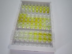 ELISA Kit for Tenascin X (TNX)