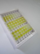 ELISA Kit for Transgelin (TAGLN)