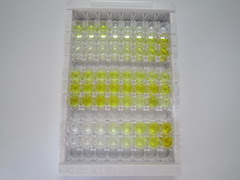 ELISA Kit for Glycyl tRNA Synthetase (GARS)