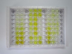 ELISA Kit for Troponin T Type 1, Slow Skeletal (TNNT1)
