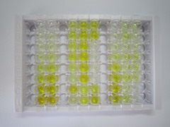 ELISA Kit for Troponin T Type 1, Slow Skeletal (TNNT1)