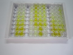 ELISA Kit for Cytochrome P450 2D6 (CYP2D6)