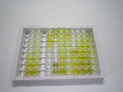 ELISA Kit for Proprotein Convertase Subtilisin/Kexin Type 9 (PCSK9)