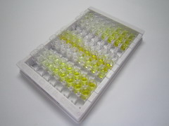 ELISA Kit for Rho GDP Dissociation Inhibitor Beta (ARHGDIb)