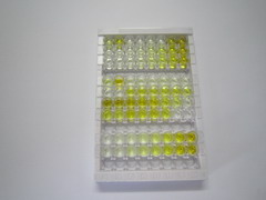 ELISA Kit for Ubiquitin Conjugating Enzyme E2I (UBE2I)