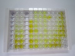 ELISA Kit for Hydroxymethylbilane Synthase (HMBS)