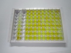 ELISA Kit for Family With Sequence Similarity 193, Member A (FAM193A)