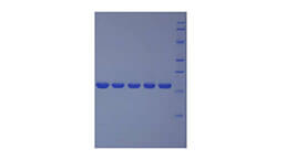 Polyacrylamide Gel Electrophoresis (PAGE) Experiment Service