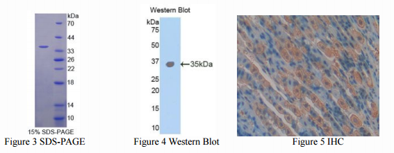TLR4-Receptor of LPS of Bacteria