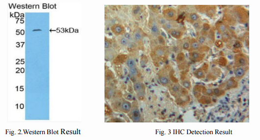 TLR4-Receptor of LPS of Bacteria 