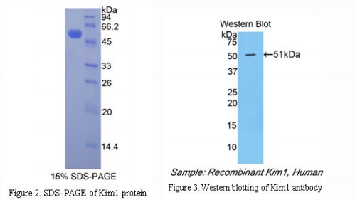 Kidney injury molecule -1 (KIM-1) - an important indicator of early kidney disease